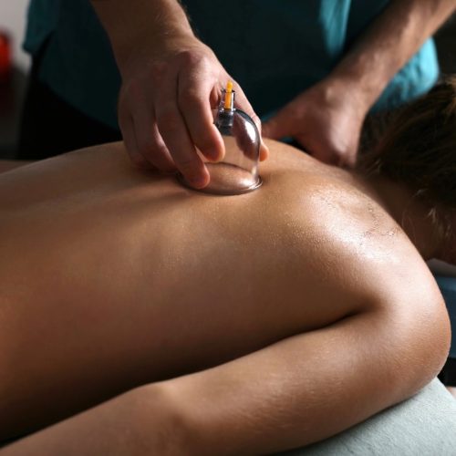 Cupping (ventosa massage), a vacuum-based massage technique.